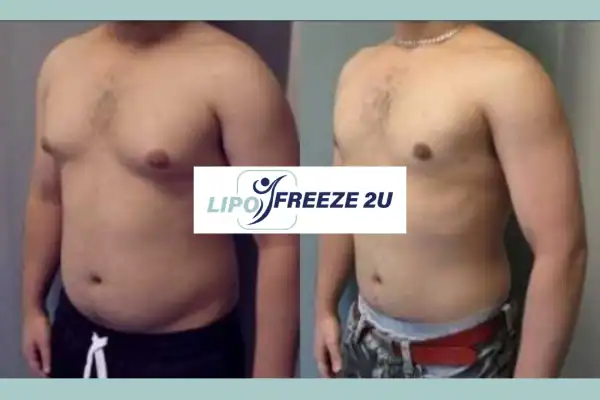 How Long Does It Take to See Results Hertfordshire?