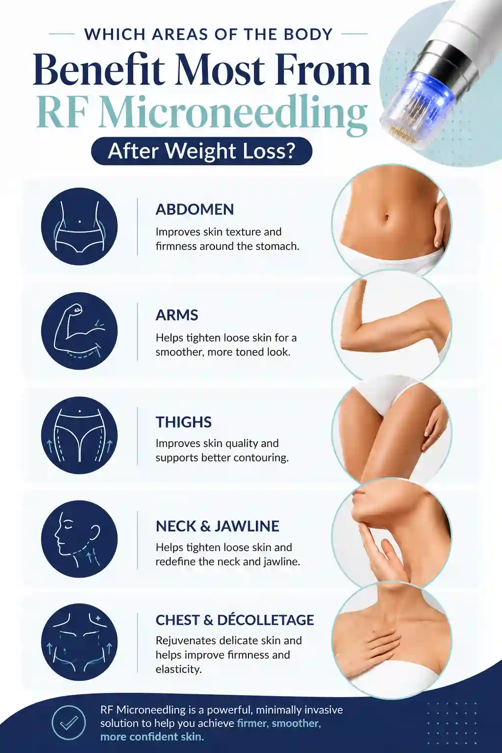 Which Areas of the Body Benefit Most From RF Microneedling After Weight Loss Hertfordshire
